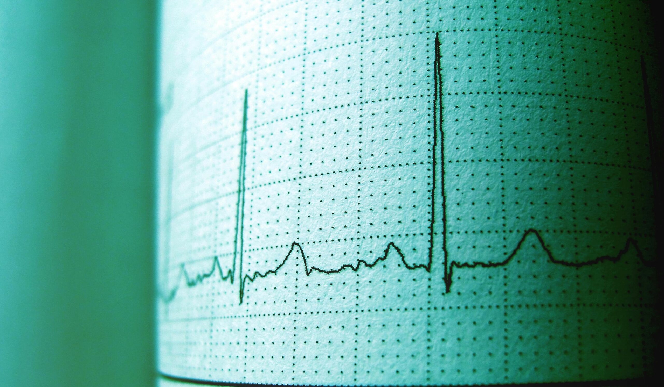 Why the Most Common Form of Heart Failure Is Also the Hardest to Treat